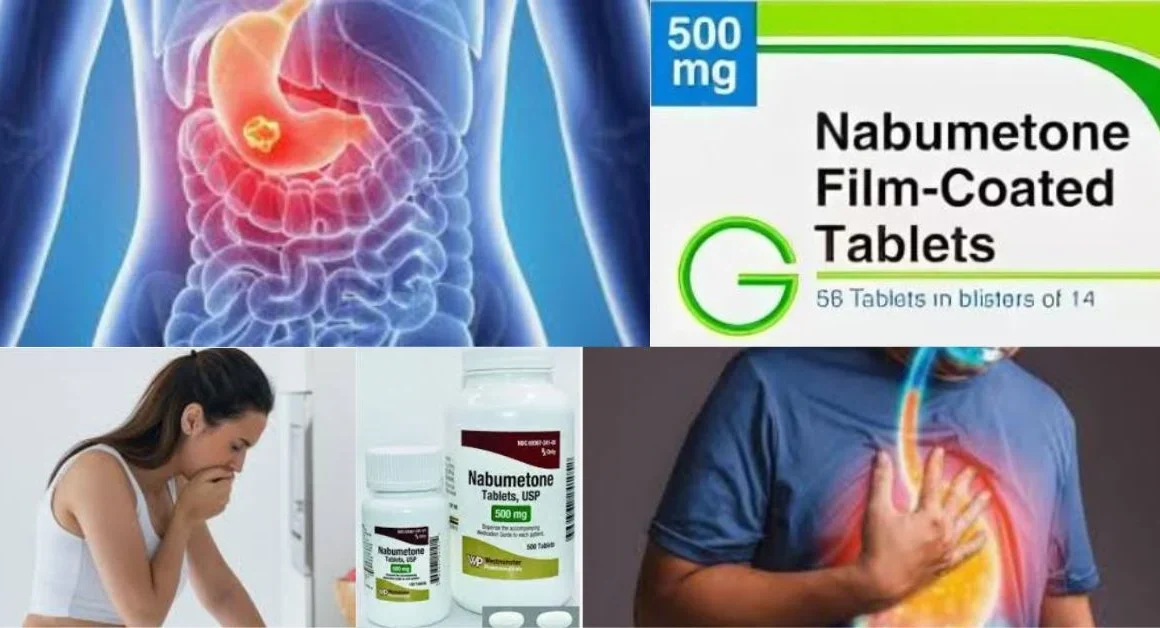 an image of Nabumetone Relieves Pain Without Causing Stomach Issues