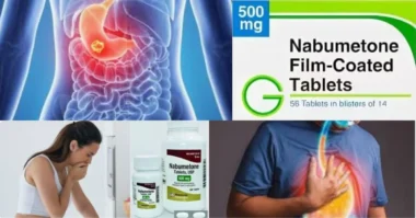 an image of Nabumetone Relieves Pain Without Causing Stomach Issues