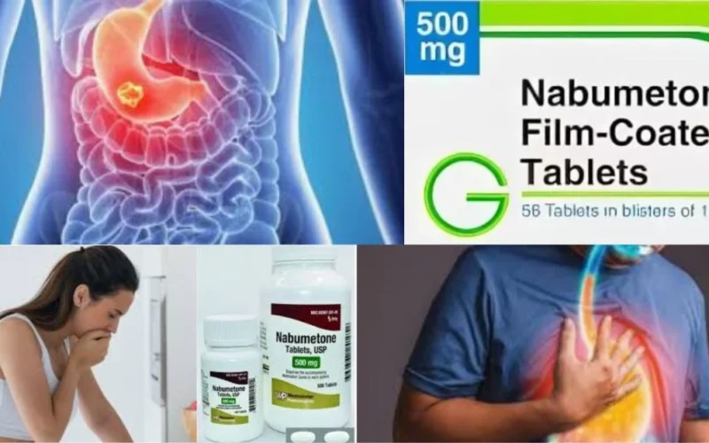 an image of Nabumetone Relieves Pain Without Causing Stomach Issues