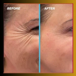 an image of Retinol’s Skin Benefits