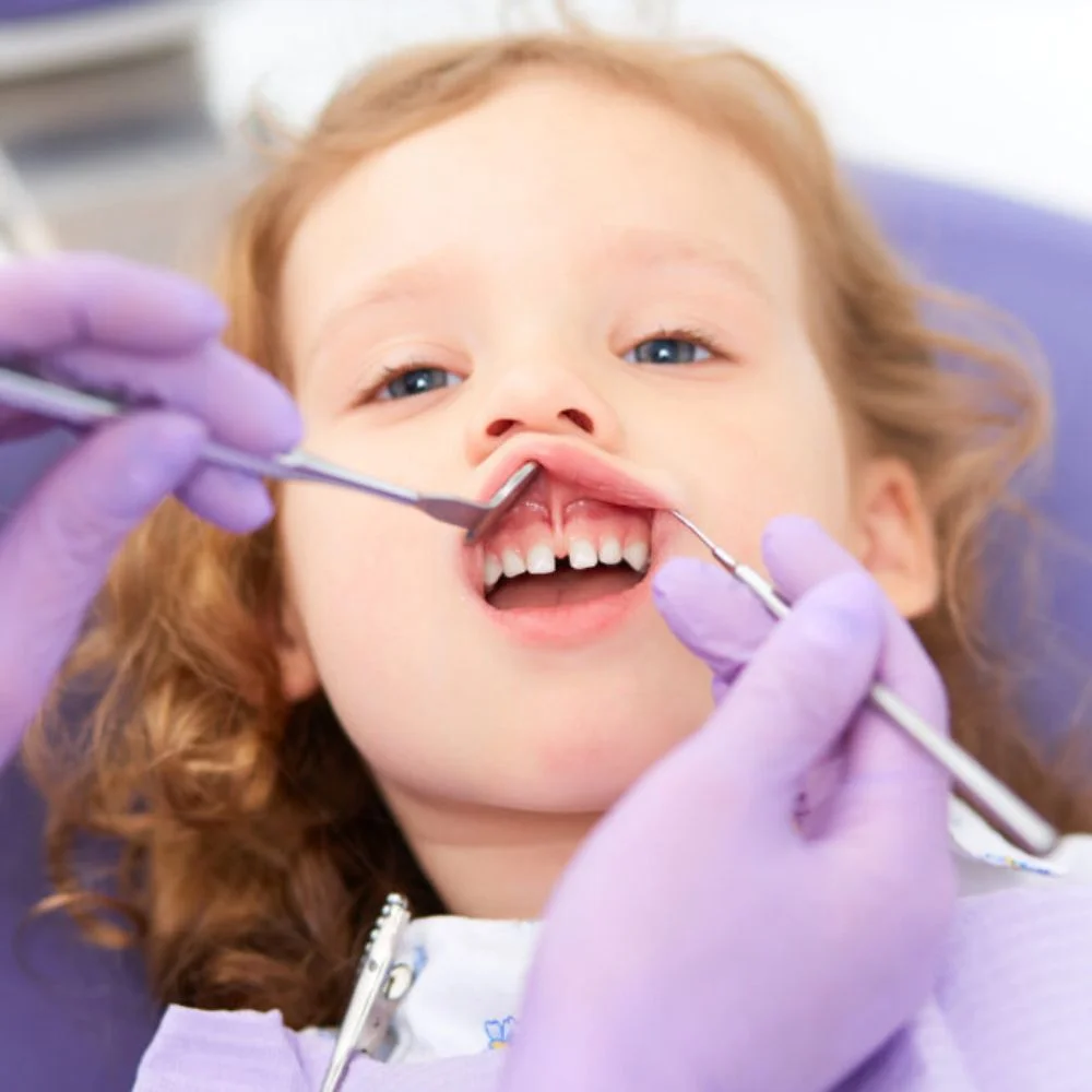 Spot and treat a lip tie