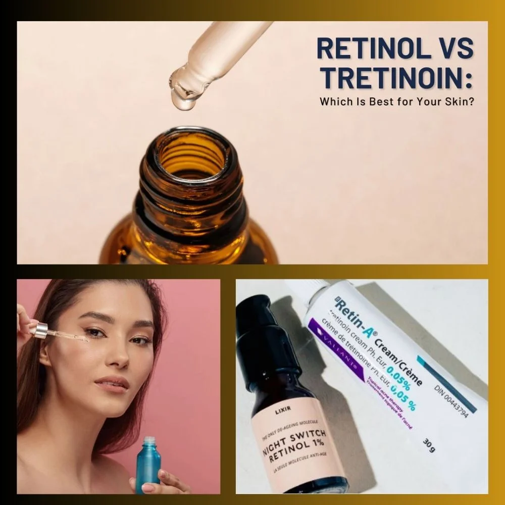 an image of Which One Is Right for You, Tretinoin or Retinol