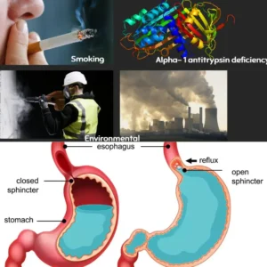 an image of Common Causes of COPD
